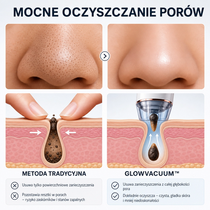 GlowVacuum™ - Profesjonalny Odkurzacz do Wągrów